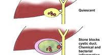 KOLELITIASIS ADALAH EBOOK DOWNLOAD KOLELITIASIS ADALAH EBOOK DOWNLOAD